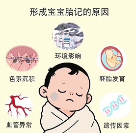 宝宝胎记是怎么形成的？南京胎记医院哪里好？